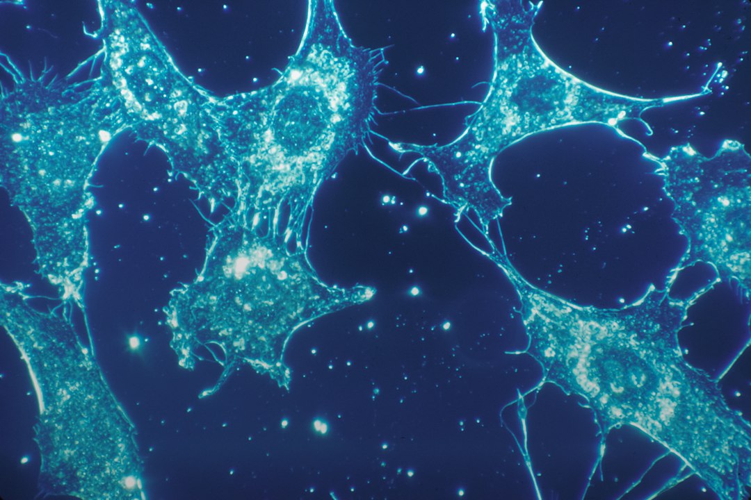 Microscopic view of human connective tissue cells