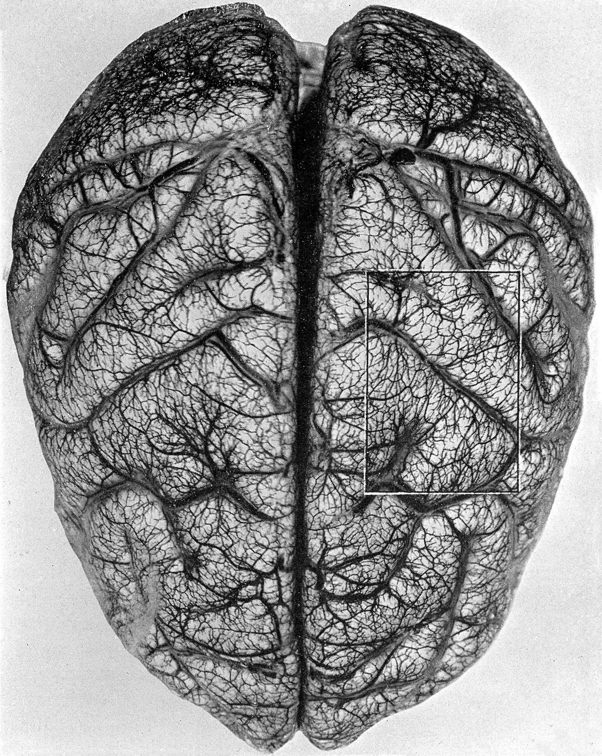 When Your Mind Begins to Change: Why Ginkgo Biloba Has Been Valued for Memory and Circulation for Generations Historical anatomical illustration showing blood vessels supplying the brain